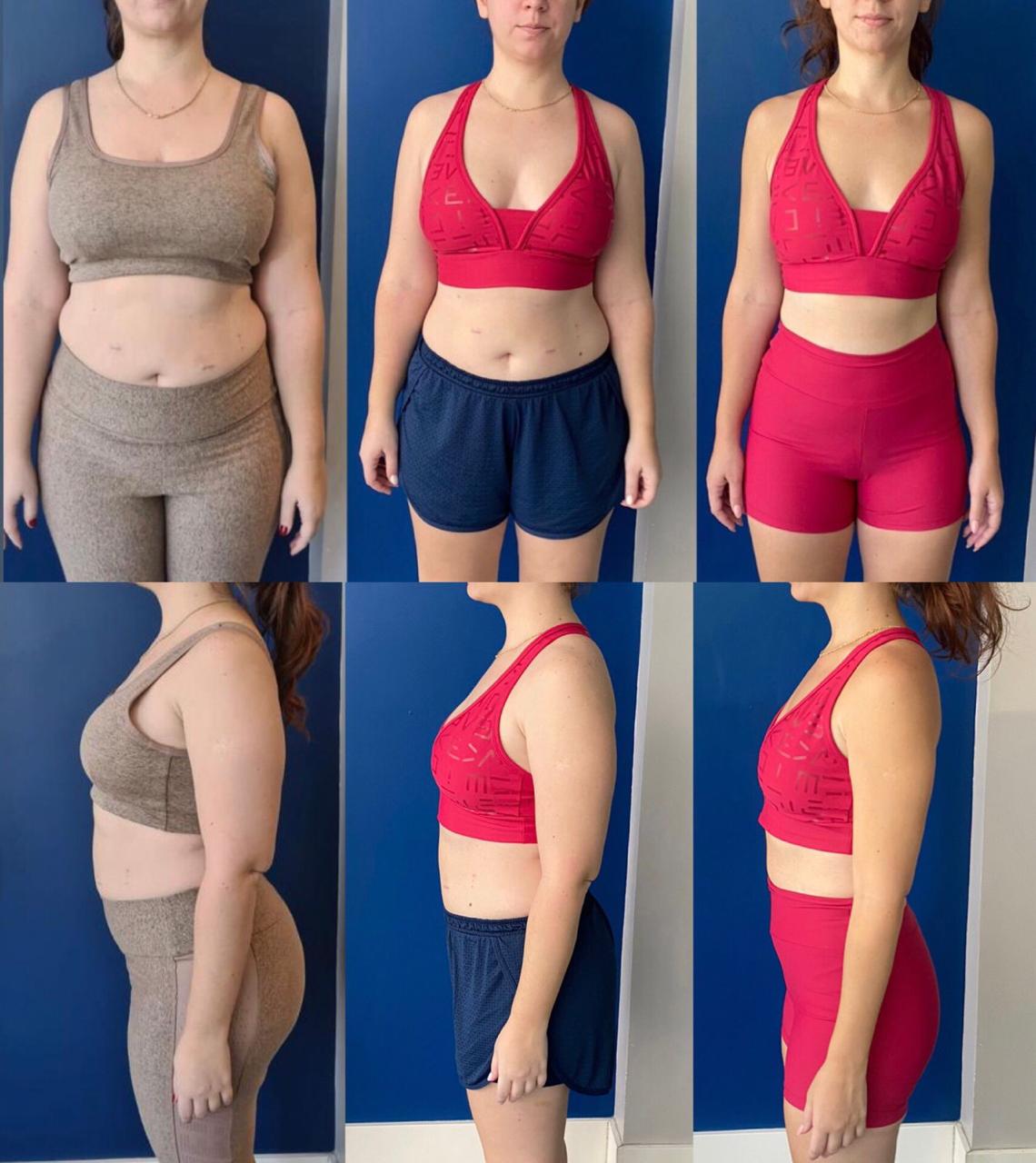 Antes e depois 4